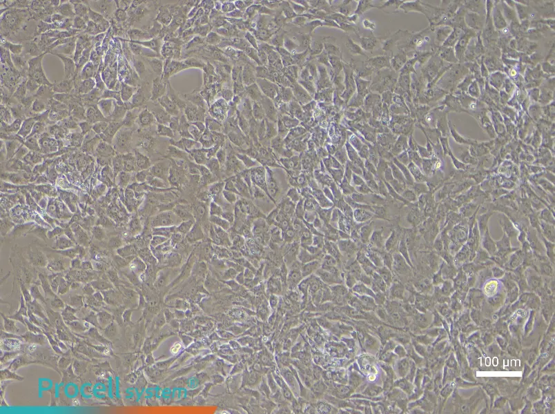 Mouse Corpus Cavernosum Smooth Muscle CellsMouse Corpus Cavernosum Smooth Muscle Cells - 3