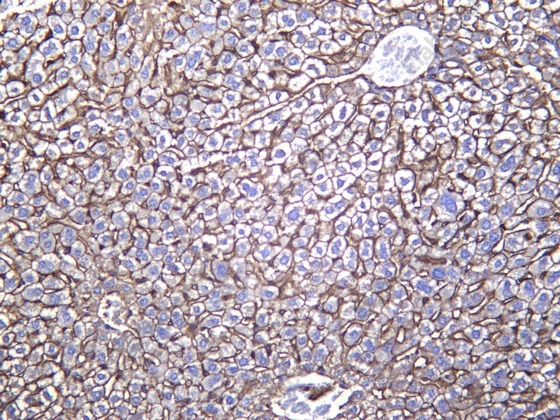 Recombinant Annexin VI Monoclonal Antibody - 2