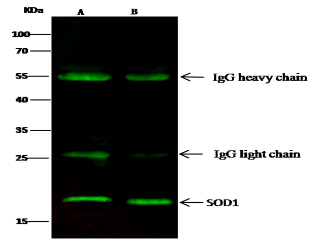 SOD1/Superoxide Dismutase Monoclonal Antibody - small - 2