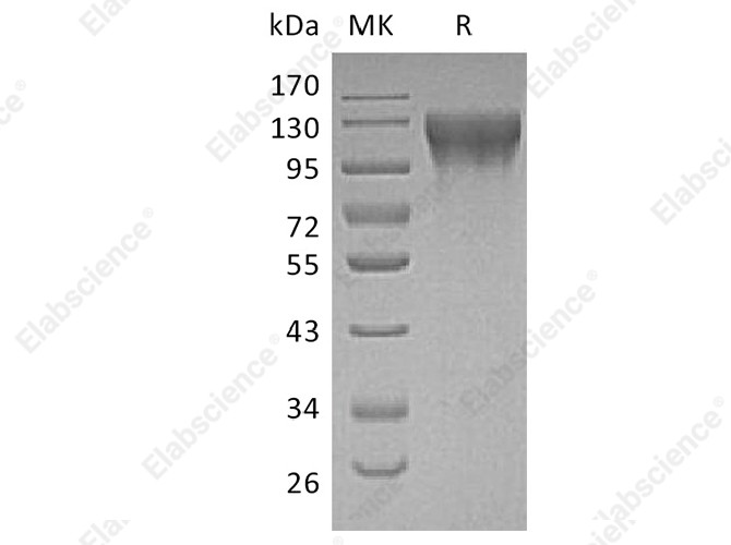 Recombinant Human ECE1 Protein (His Tag) - 1
