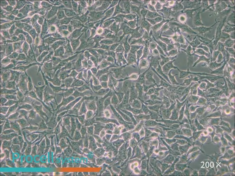 NCI-H3122 - 4
