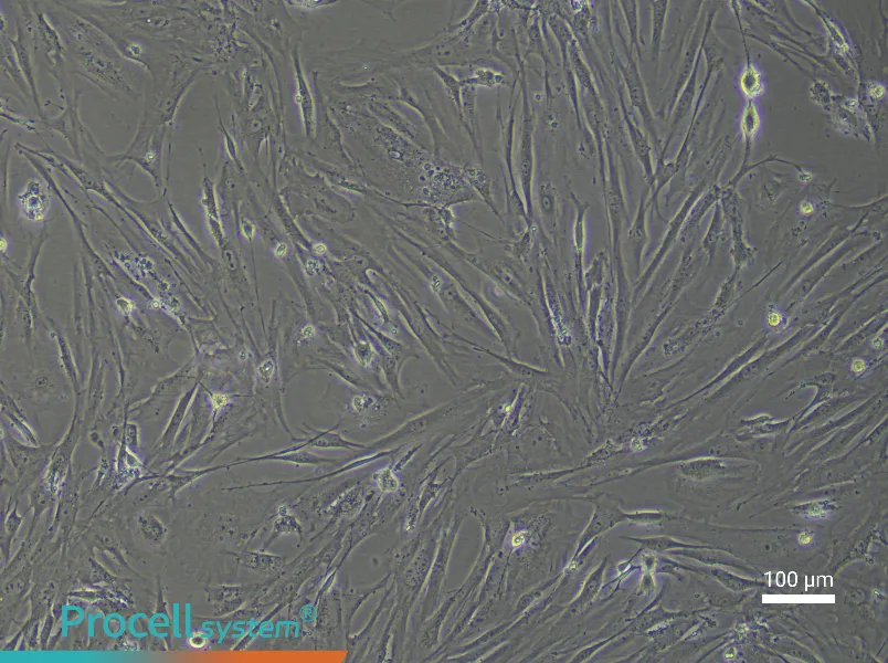 Mouse Pancreatic Stellate Cell Complete Medium - 2