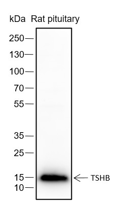 Recombinant TSHB Monoclonal Antibody-searchlist-1