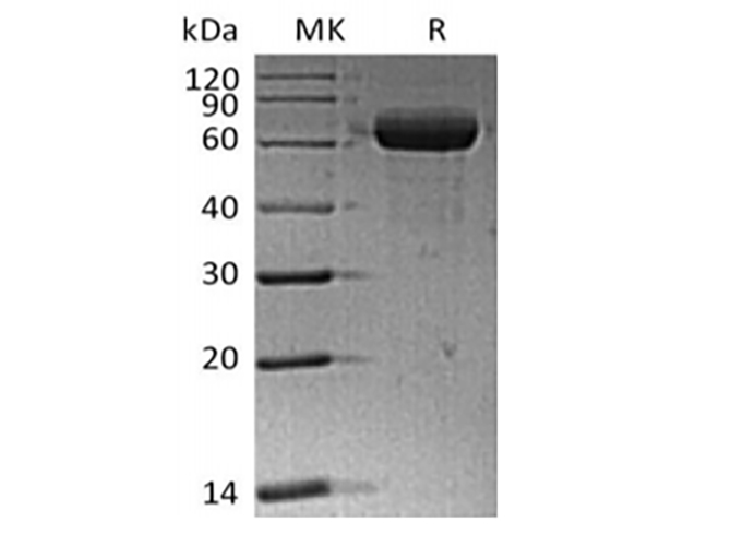 Immobilized Human Siglec-15-Fc at 2ug/ml (100 ul/well) can bind Anti-Human Siglec15 mAb. The ED50 of Anti-Human Siglec15 mAb is 16.8 ng/ml.