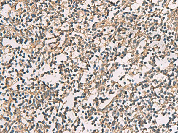 Immunohistochemistry of paraffin-embedded Human tonsil tissue  using CMTM4 Polyclonal Antibody at dilution of 1:55(?200)