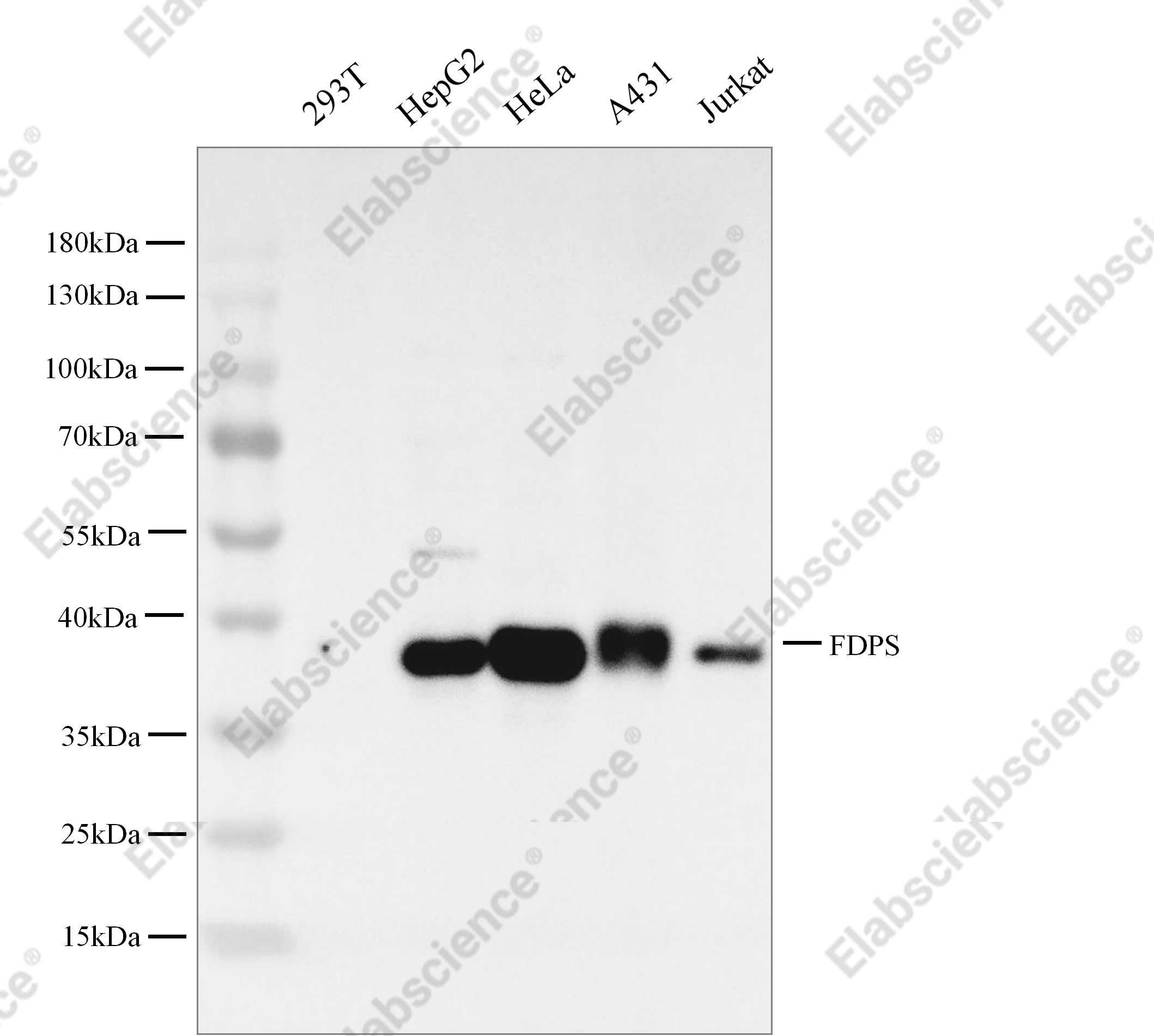 Recombinant FDPS/Farnesyl Diphosphate Synthase Monoclonal Antibody - 2