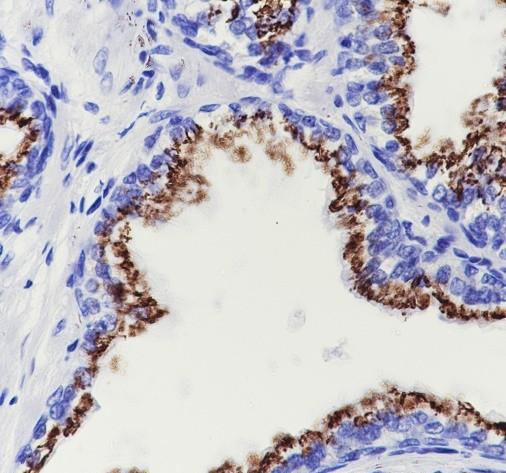 Recombinant SLC45A3 Monoclonal Antibody - 2