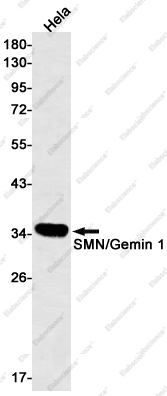 Recombinant Gemin 1 Monoclonal Antibody - 1