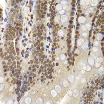 Immunohistochemistry of paraffin-embedded Rat Intestine using SMARCB1 Polyclonal Antibody at dilution of  1:200 (40x lens).