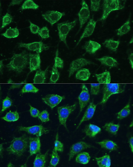 Immunofluorescence analysis of L-929 cells using PTPN22 Polyclonal Antibody at dilution of 1:100. Blue: DAPI for nuclear staining.