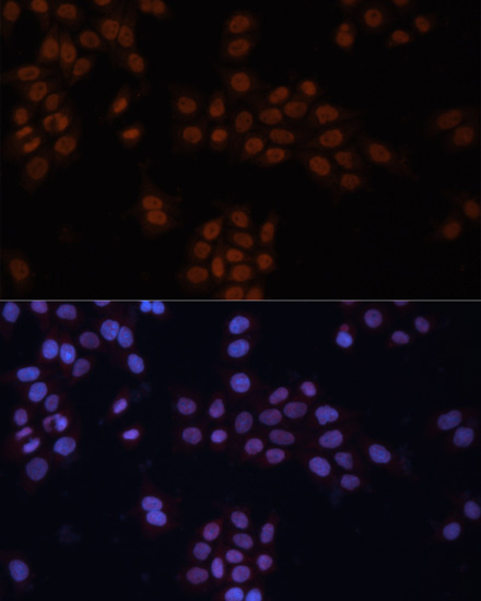 Immunofluorescence analysis of HeLa cells using GTF2I Polyclonal Antibody at dilution of  1:100. Blue: DAPI for nuclear staining.