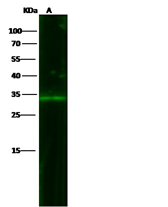 Recombinant EpCAM/TROP-1/TACSTD1 Monoclonal Antibody - small - 6