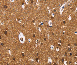 ILK Polyclonal Antibody - 3