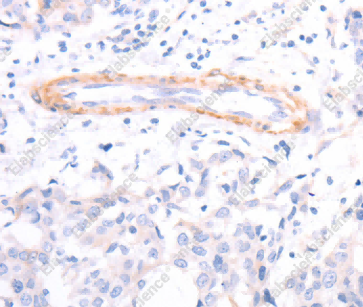 TPM1 Polyclonal Antibody - 3