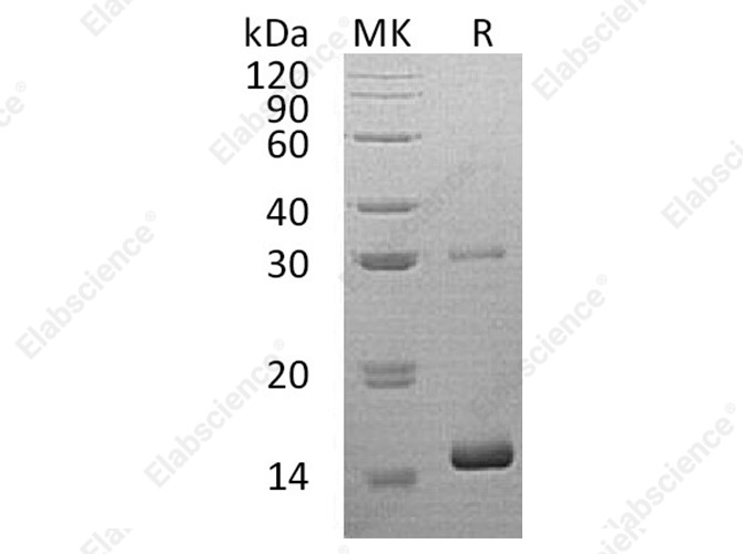 Recombinant Human HBQ1 Protein (His Tag) - 1