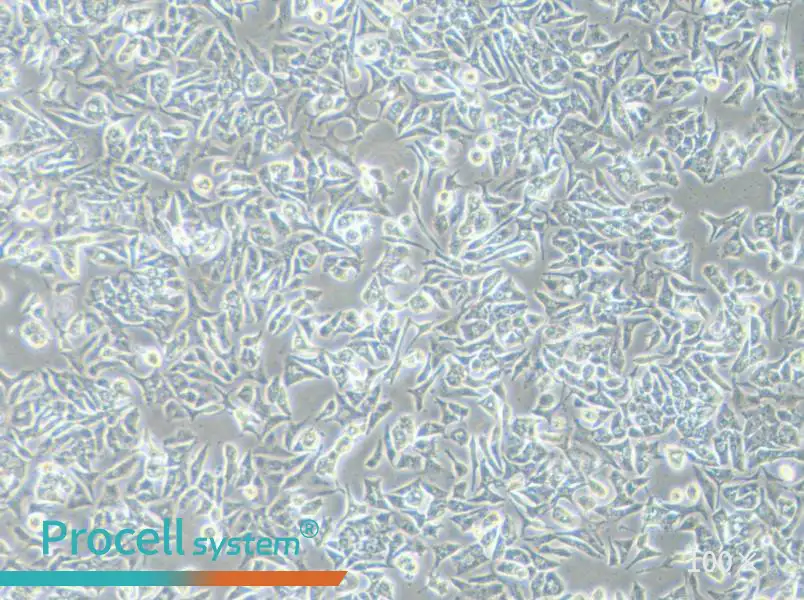 VCaP Cell Complete Medium - 3