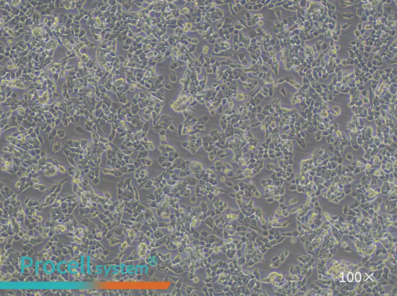 A2780 Cell Complete Medium - 1