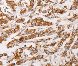 AK2 Polyclonal Antibody - 3