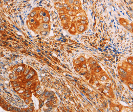 SLC25A4 Polyclonal Antibody - 3