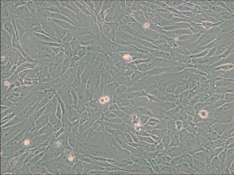 SW 982 [SW-982, SW982] (L15) Cell Complete Medium - small - 5