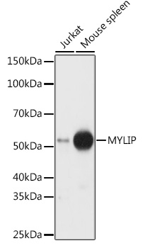 Western blot analysis of extracts of various cell lines using MYLIP Polyclonal Antibody at 1:1000 dilution.