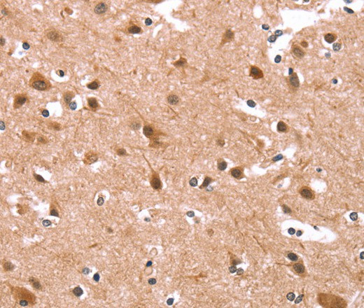 Immunohistochemistry of paraffin-embedded Human brain tissue using KCNJ6 Polyclonal Antibody at dilution 1:40