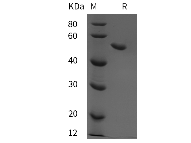 Recombinant Human TGFβ1 Protein-产品推荐-1