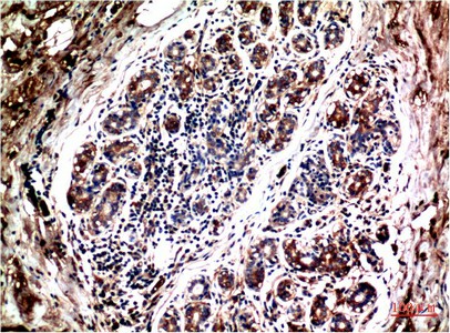 AKT1 Monoclonal Antibody
