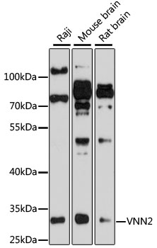 Western blot analysis of extracts of various cell lines using VNN2 Polyclonal Antibody at 1:1000 dilution.