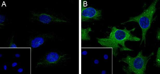 Recombinant Phospho-HSP27 (Ser78) Monoclonal Antibody - small - 5