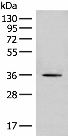 Western blot analysis of Hela cell lysate  using MLST8 Polyclonal Antibody at dilution of 1:500