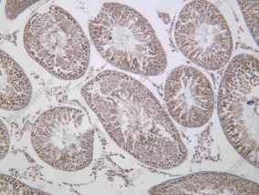 Recombinant PHKG2 Monoclonal Antibody - 2