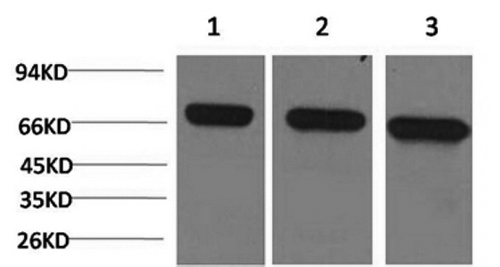 Western Blot analysis of 1) Hela, 2)Mouse brain, 3) Rat brain using HSPA8 Monoclonal Antibody at dilution of 1:2000.