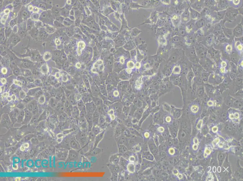 NCI-H1915 Cell Complete Medium - 6