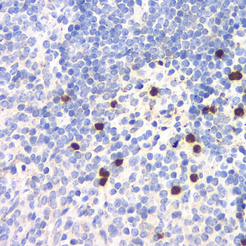 Immunohistochemistry analysis of paraffin-embedded mouse spleen  using TLR9 Polyclonal Antibody at dilution of 1:200.