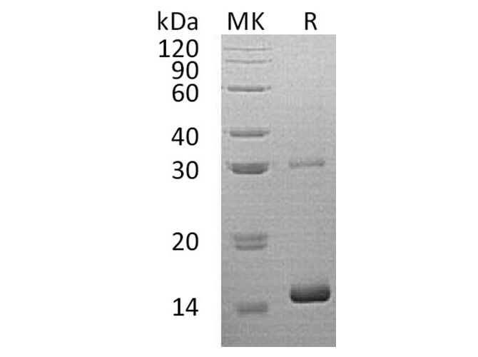 Recombinant Human HBQ1 Protein (His Tag)