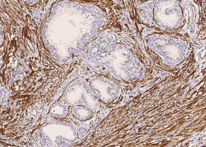 Recombinant MYH11 Monoclonal Antibody-searchlist-1