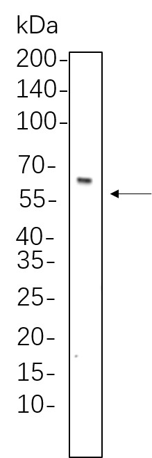 Recombinant Smad4 Monoclonal Antibody-searchlist-1