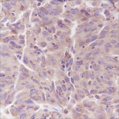 Recombinant PI3 Kinase p85 alpha Monoclonal Antibody-searchlist-1