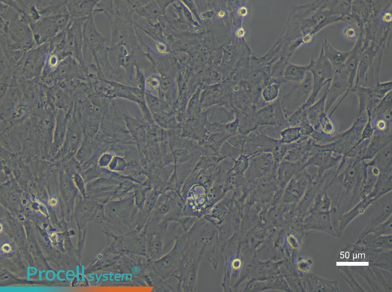 Rat Uterine Fibroblast Complete Medium - 5