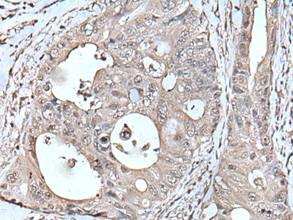 TPT1 Polyclonal Antibody - small - 3