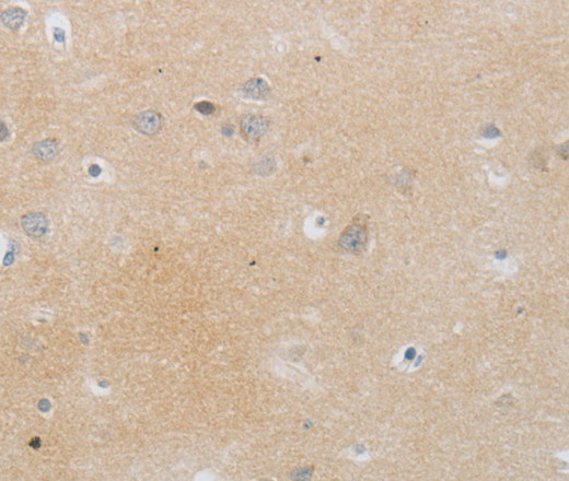 Immunohistochemistry of paraffin-embedded Human brain tissue using MMP25 Polyclonal Antibody at dilution 1:80