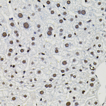 Immunohistochemistry of paraffin-embedded mouse liver using GTF2I Polyclonal antibody (40x lens).Perform microwave antigen retrieval with 10 mM PBS buffer pH 7.2 before commencing with IHC staining protocol.