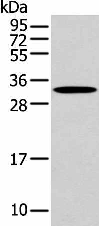 Western blot analysis of Mouse muscle tissue  using NANOS1 Polyclonal Antibody at dilution of 1:500