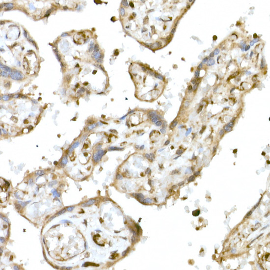 Immunohistochemistry of paraffin-embedded human placenta using NRF2 Polyclonal antibody at dilution of 1:100 (40x lens).Perform high pressure antigen retrieval with 10 mM citrate buffer pH 6.0 before commencing with IHC staining protocol.