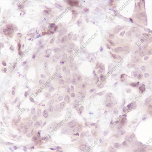 Recombinant Caspase-7 Monoclonal Antibody - 2