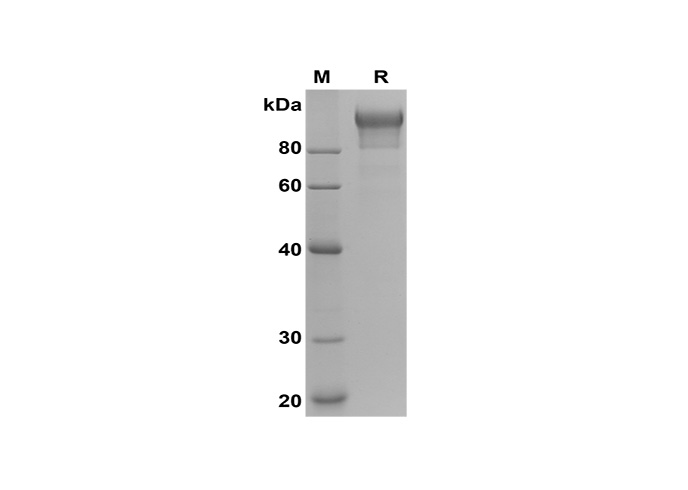 Recombinant Mouse IL-11 Protein(Sumo Tag)-产品推荐-1