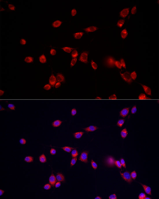 Immunofluorescence analysis of NIH/3T3 cells using ATP13A2 Polyclonal Antibody at dilution of 1:50 (40x lens). Blue: DAPI for nuclear staining.