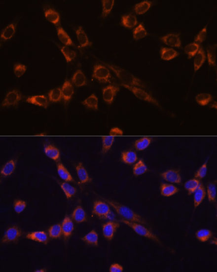 Immunofluorescence analysis of NIH-3T3 cells using STK3/MST2 Polyclonal Antibody at dilution of 1:100 (40x lens). Blue: DAPI for nuclear staining.