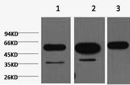 Western Blot analysis of 1) Hela, 2) Mouse brain, 3) Rat brain using beta Tubulin Monoclonal Antibody at dilution of 1:5000.